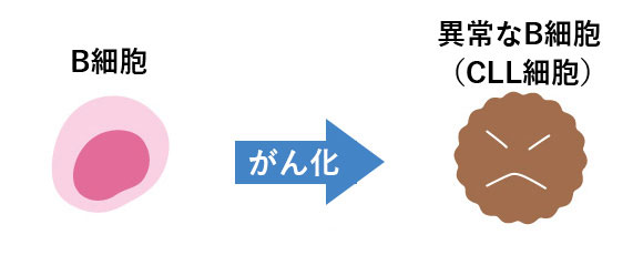 B細胞のがん化