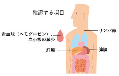 Rai（ライ）分類