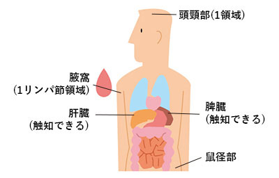 Binet（ビネ）分類