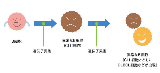 リヒター症候群