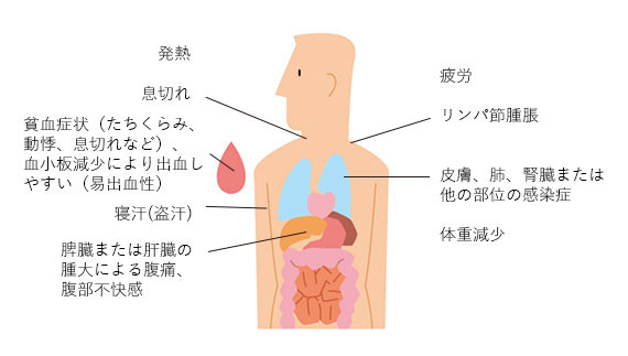 CLL細胞が体内で増えてくると、症状が出てくる